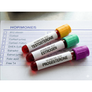 Perfil Hormonal Hombre