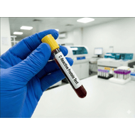 Proteína C Reactiva