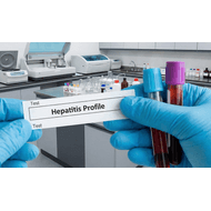 Perfil Hepatitis
