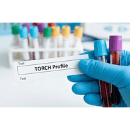 Perfil Torch